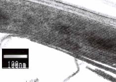 MLE - unikalna technologia wielowarstwowej emulsji (MLE-Multi Lamellar Emulsion) Wielowarstwowa struktyra lipidow skory Krzyż Maltański