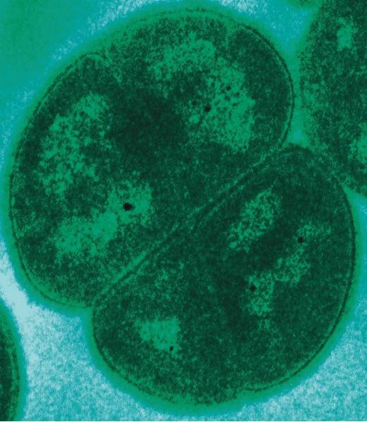 PANSPERMIA: PROBLEMY Bakterie z wysoką odpornością na promieniowanie: Bacillus subtilis Deinococcus radiodurans (wewnątrz reaktorów jądrowych), odporna na