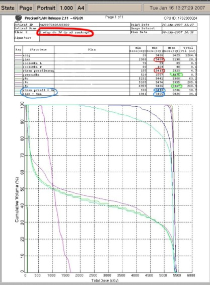 Rys CO 22. Histogram z planu leczenia.