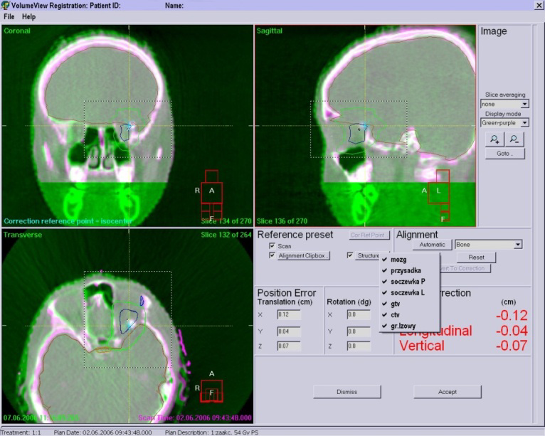 napromienianiem, pacjentowi przygotowanemu do napromieniania, wykonuje się badanie CBCT (trwa to 2-3 min.).