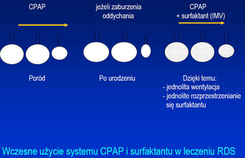 Wsparcie oddechu u noworodka od pierwszych minut życia Poród ncpap