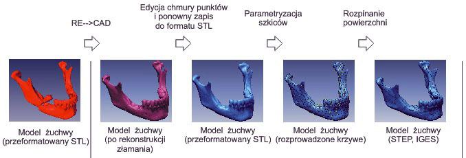 Należy ona do grupy metod obszarowych, które polegają na wyborze pikseli o podobnym odcieniu i zakwalifikowaniu ich do jednej grupy określającej daną tkankę (obszaru jednorodności).