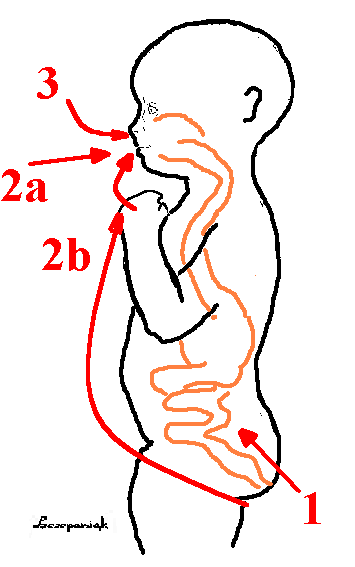 Enterobius vermicularis drogi zakażenia 1)retroinwazja