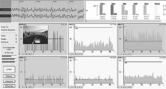124 WOJCIECH GOLUS, ZDZISŁAW ŁOJEWSKI analizie zapisu EEG pacjenta, podłączonego poprzez elektrody do systemu. Pacjent kontroluje przebieg akcji na planszy stymulacyjnej wyłącznie poprzez swoje myśli.