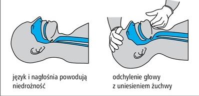 Jeśli poszkodowany NIE zareagował: Zawołaj głośno o pomoc