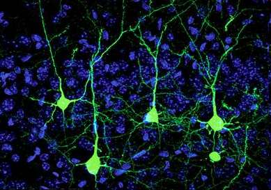 Dwa rodzaje komórek układu nerwowego Neurony (komórki nerwowe, neurocyty) wyspecjalizowane komórki odbierające, przetwarzające i przekazujące pobudzenia (przetwarzające informacje).
