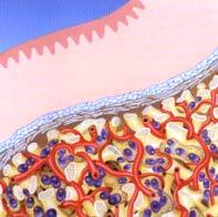 Bioceramika oparta o fosforany wapnia - zastosowanie Zastosowanie porowatej ceramiki fosforanowej: wypełnianie ubytków kostnych w stomatologii i ortopedii w charakterze nośników leków