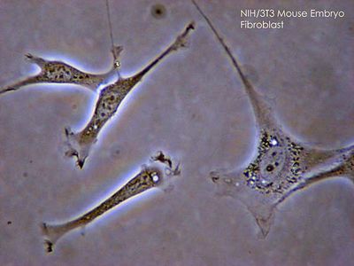 Fibroblasty Histiocyty (makrofagi tkanki łącznej właściwej) Przebieg fagocytozy a. nibynóżki obejmują patogen, powstaje fagosom b. połączenie fagosomu z lizosomem c.