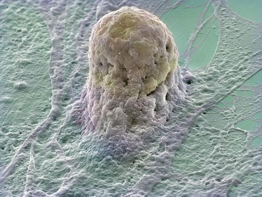 Komórka macierzysta zdolność do nieograniczonych podziałów