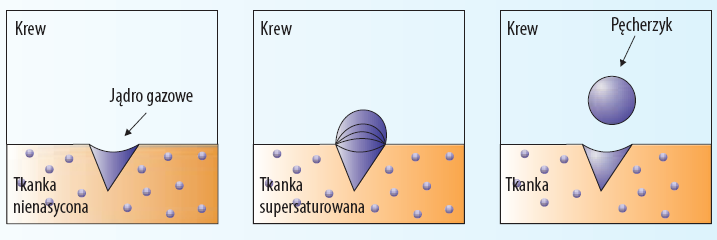 Koncepcja jąder gazowych W 1951 r. dr Harvey wskazał na istotną rolę tzw. jąder gazowych w powstawaniu i rozwoju pęcherzyków gazowych w DCS. 1. Przy zbyt dużym spadku ciśnienia otaczającego we krwi i tkankach organizmu powstają pęcherzyki gazowe.