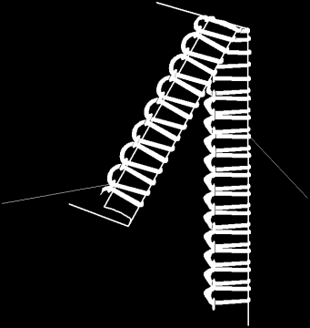 Napężni nici od igły lub nici od dolngo mchanizmu js ozguloan (2) o 0 1 Rysunk pokazuj zula szycia, gdy napężni nici dolngo mchanizmu pęlującgo js za słab i/lub napężni nici od igły js zby mocn mał.