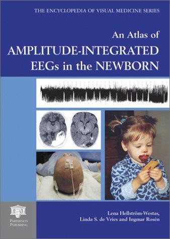 An Atlas of Amplitude-Integrated EEGs in the Newborn