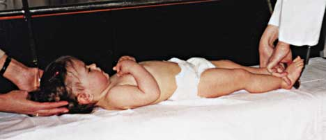 2 z 10 2013-06-24 00:21 Fot. 1. Liberometr służący do pomiaru długości ciała i cech długościowych niemowląt w pozycji leżącej. Fot. 2. Sposób pomiaru długości ciała niemowlęcia za pomocą liberometru.
