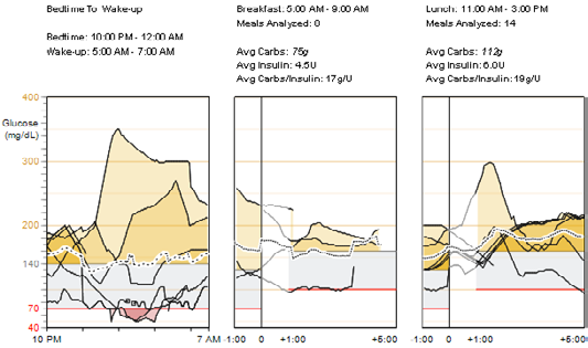 Nałożenie stężenia glukozy z czujnika od pójścia spać do pobudki i przy posiłkach odczyty i wartości średnie Na wykresach Bedtime to Wake-Up (Od pójścia spać do pobudki) i Meal Periods (Pory