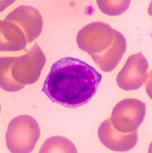 limfocyty NK komórki dendrytyczne Jeśli
