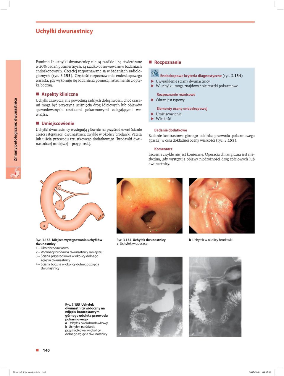 Rozpoznanie Endoskopowe kryteria diagnostyczne (ryc.