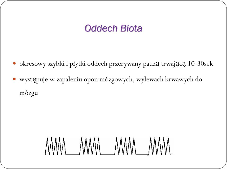 trwającą 10-30sek występuje w