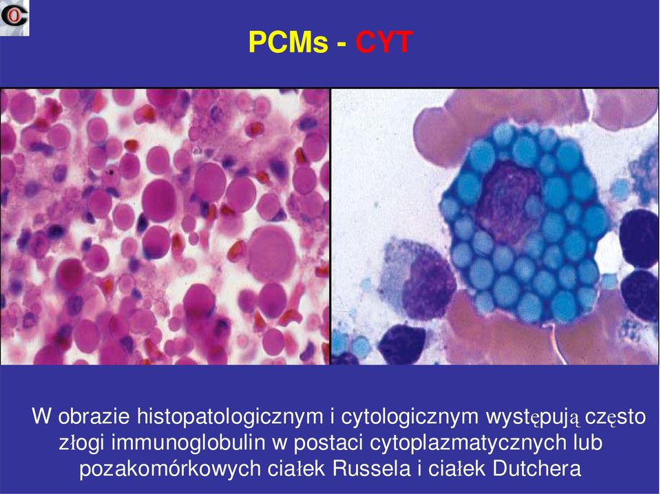 immunoglobulin w postaci cytoplazmatycznych