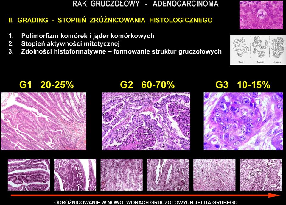 Polimorfizm komórek i jąder komórkowych 2. Stopień aktywności mitotycznej 3.