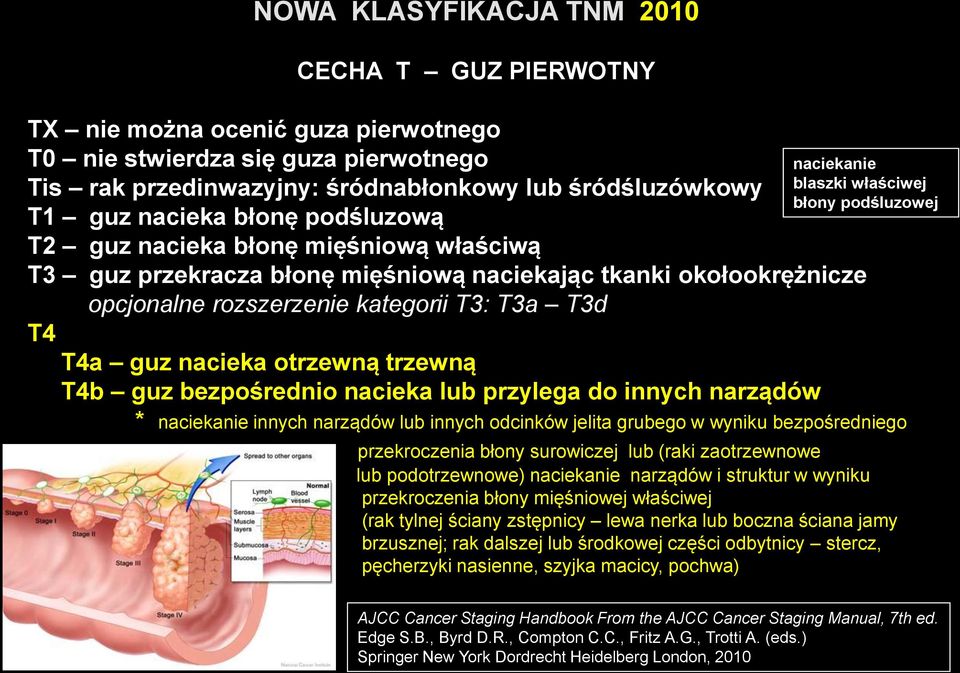 otrzewną trzewną T4b guz bezpośrednio nacieka lub przylega do innych narządów naciekanie blaszki właściwej błony podśluzowej * naciekanie innych narządów lub innych odcinków jelita grubego w wyniku