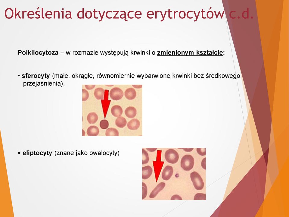 Poikilocytoza w rozmazie występują krwinki o zmienionym