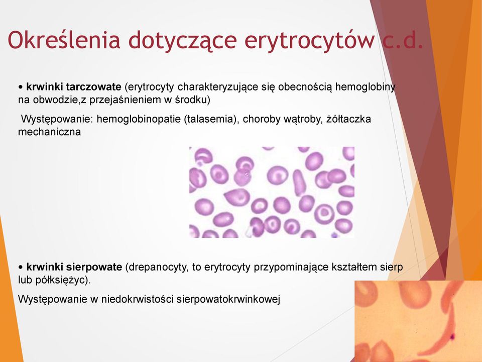 krwinki tarczowate (erytrocyty charakteryzujące się obecnością hemoglobiny na obwodzie,z