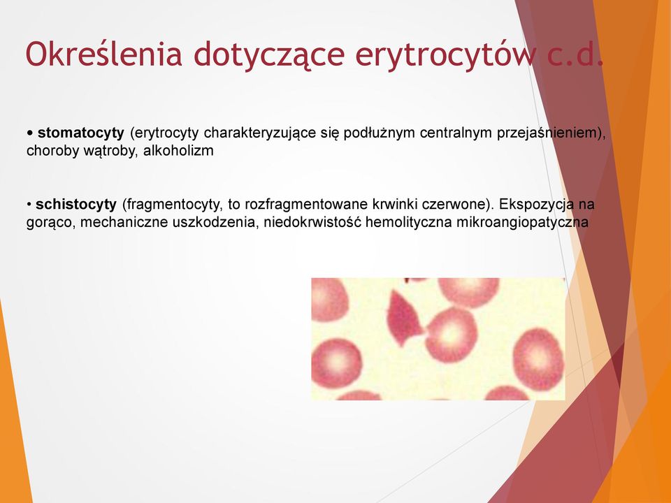 stomatocyty (erytrocyty charakteryzujące się podłużnym centralnym