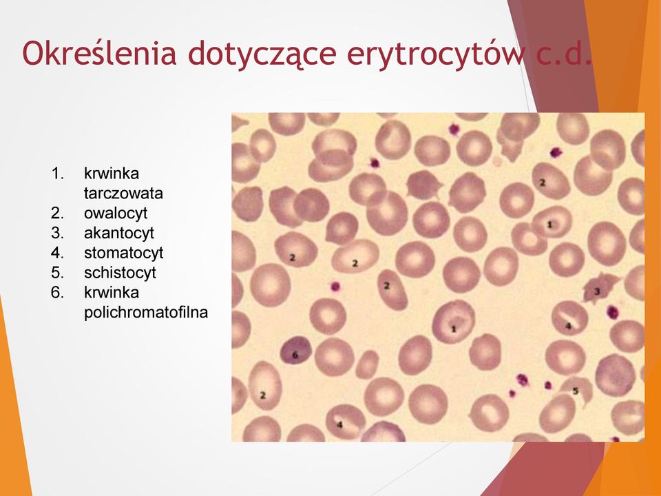 owalocyt 3. akantocyt 4.