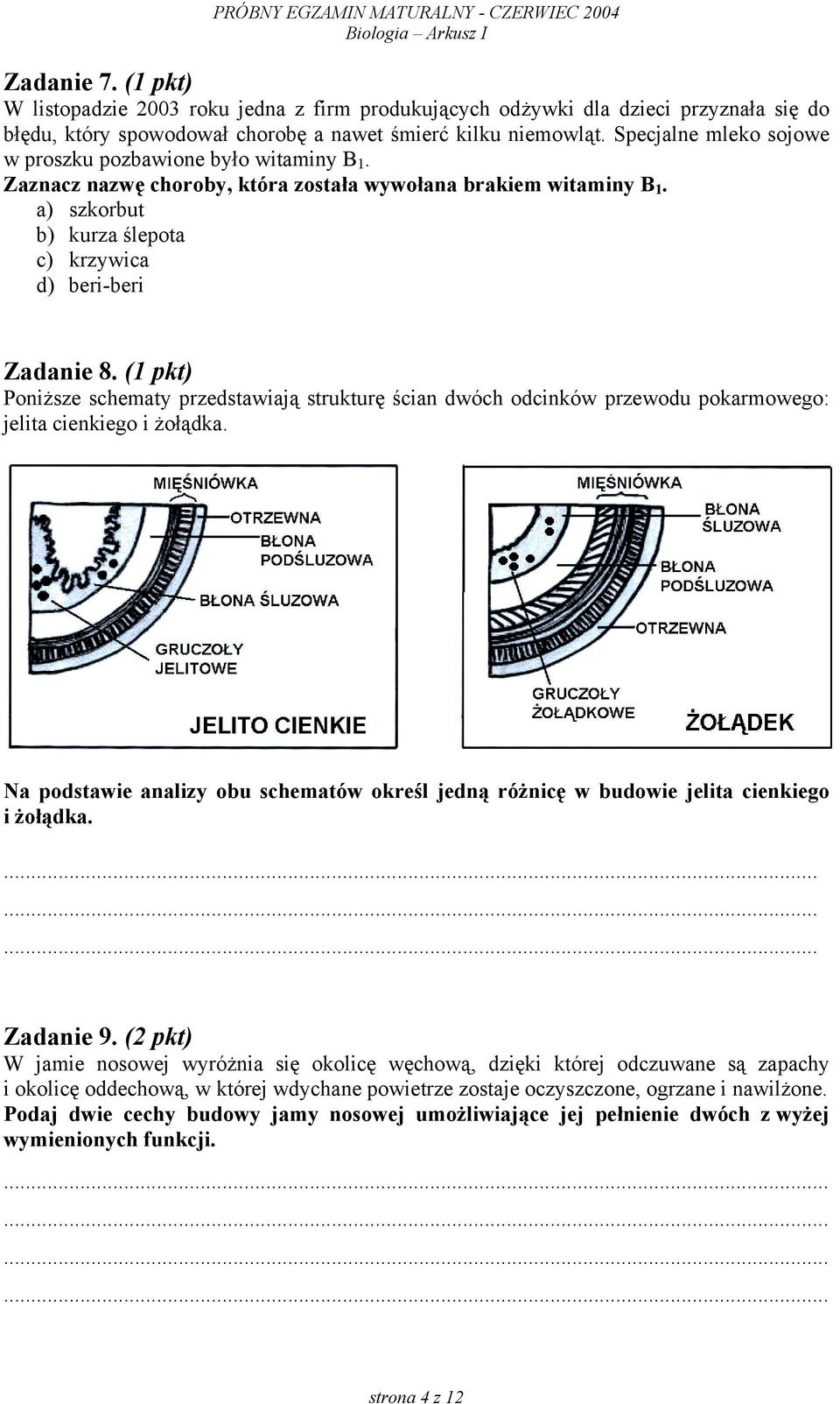 (1 pkt) Poniższe schematy przedstawiają strukturę ścian dwóch odcinków przewodu pokarmowego: jelita cienkiego i żołądka.