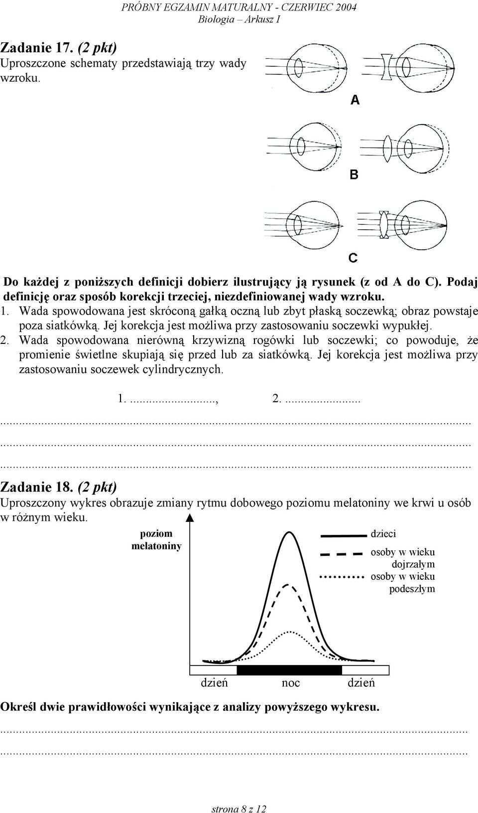 Jej korekcja jest możliwa przy zastosowaniu soczewki wypukłej. 2. Wada spowodowana nierówną krzywizną rogówki lub soczewki; co powoduje, że promienie świetlne skupiają się przed lub za siatkówką.