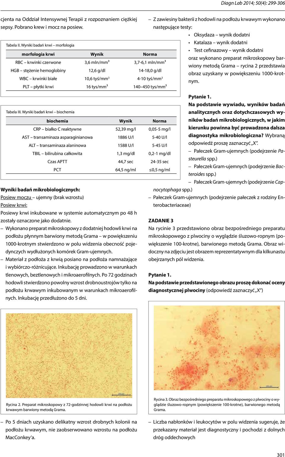 Wyniki badań krwi morfologia Katalaza wynik dodatni Test cefinazowy wynik dodatni morfologia krwi Wynik Norma oraz wykonano preparat mikroskopowy barwiony metodą Grama rycina 2 przedstawia RBC