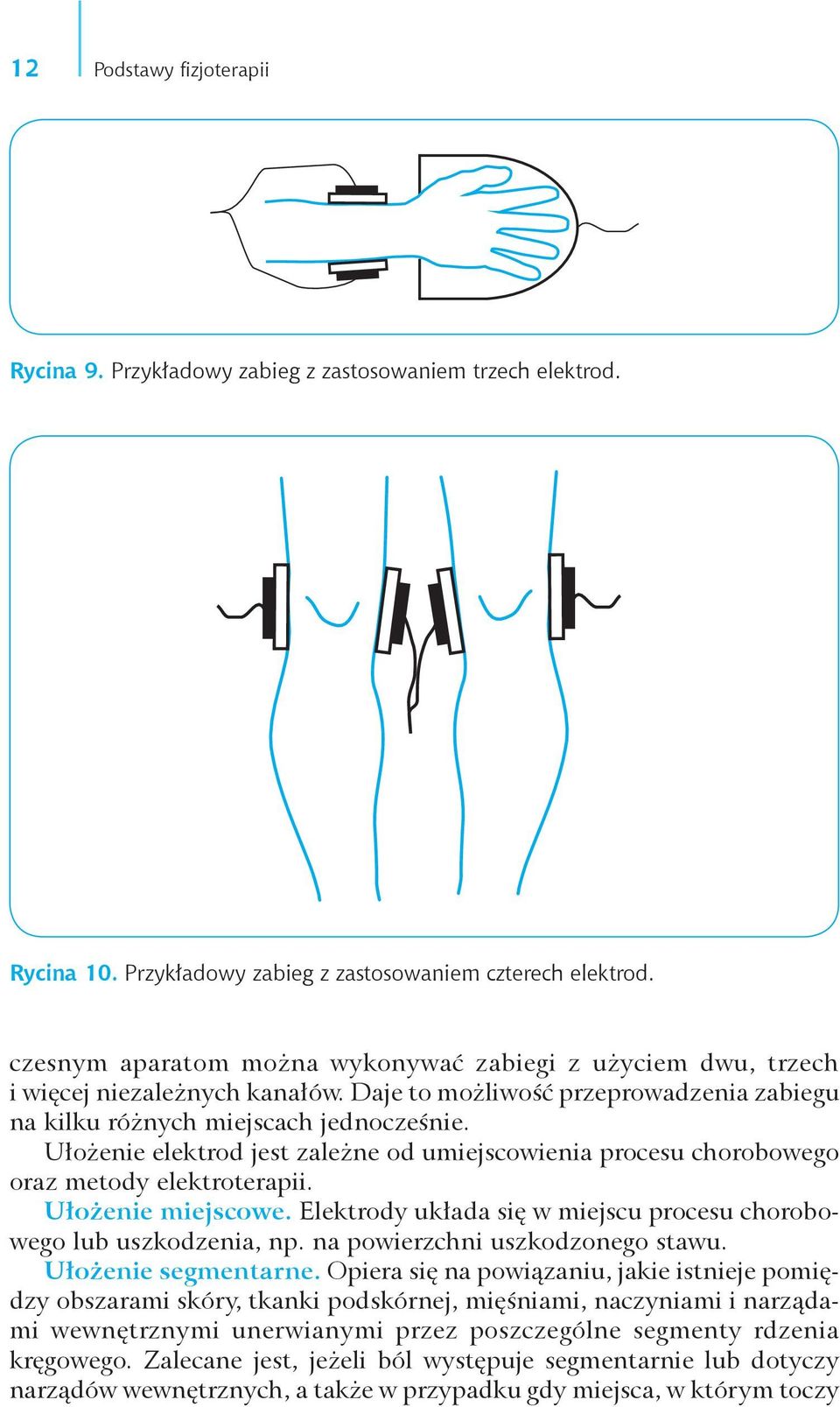 Ułożenie elektrod jest zależne od umiejscowienia procesu chorobowego oraz metody elektroterapii. Ułożenie miejscowe. Elektrody układa się w miejscu procesu chorobowego lub uszkodzenia, np.