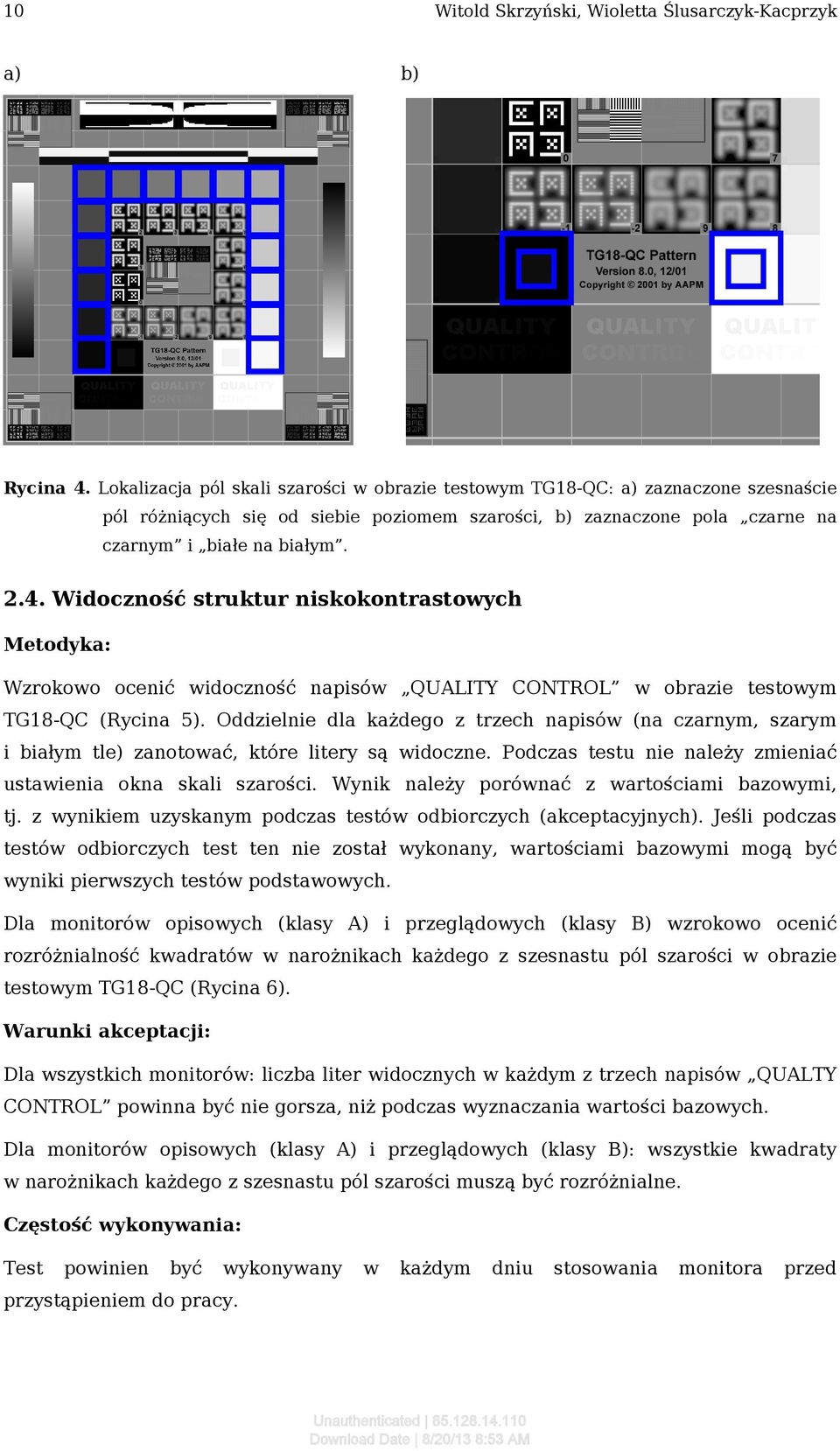 Widoczność struktur niskokontrastowych Wzrokowo ocenić widoczność napisów QUALITY CONTROL w obrazie testowym TG18-QC (Rycina 5).