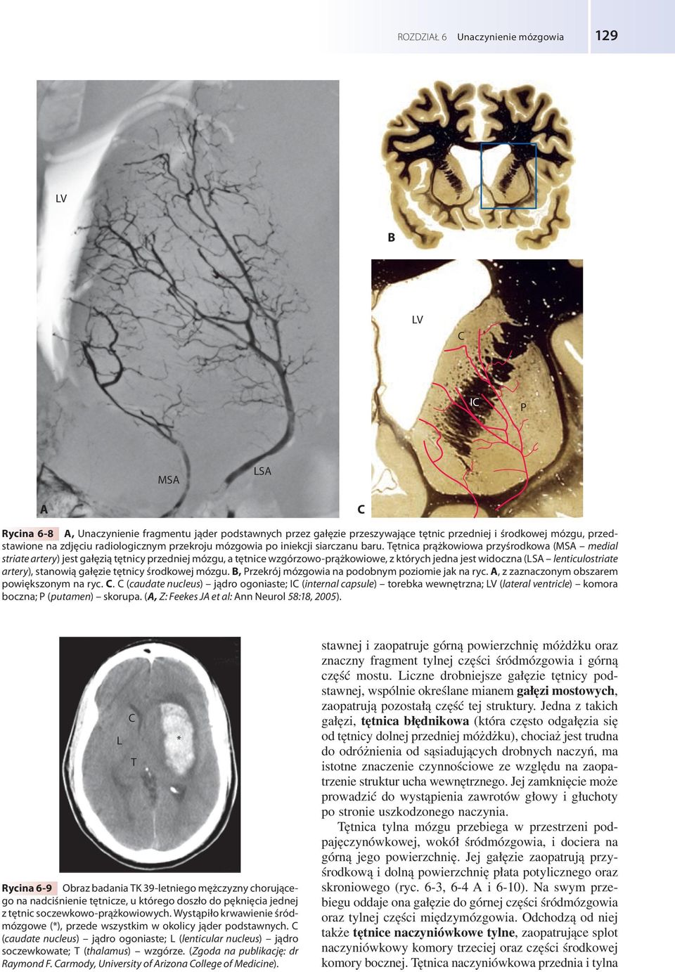 Tętnica prążkowiowa przyśrodkowa (MS medial striate artery) jest gałęzią tętnicy przedniej mózgu, a tętnice wzgórzowo-prążkowiowe, z których jedna jest widoczna (LS lenticulostriate artery), stanowią