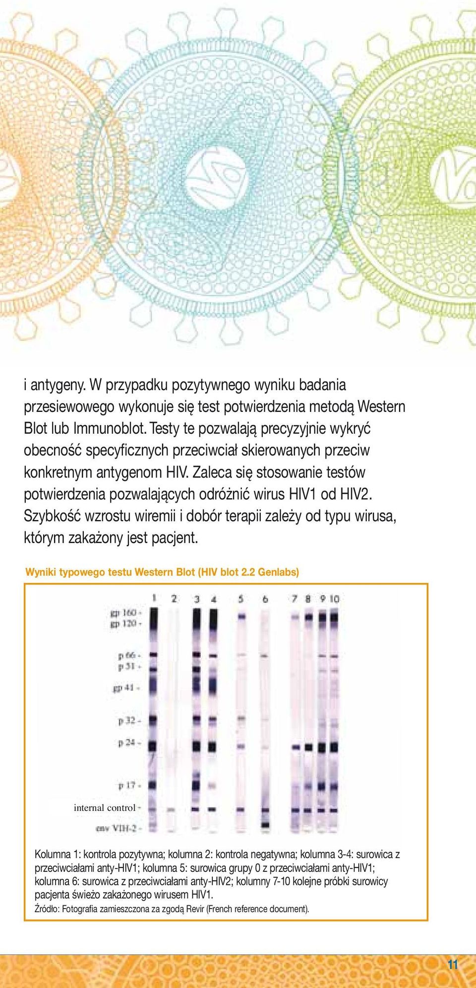 Zaleca się stosowanie testów potwierdzenia pozwalających odróżnić wirus HIV1 od HIV2. Szybkość wzrostu wiremii i dobór terapii zależy od typu wirusa, którym zakażony jest pacjent.