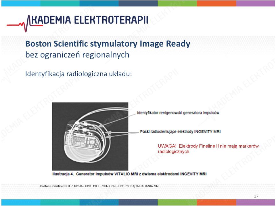 Elektrody Fineline II nie mają markerów radiologicznych