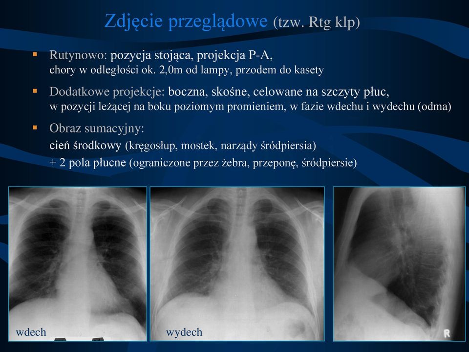 leżącej na boku poziomym promieniem, w fazie wdechu i wydechu (odma) Obraz sumacyjny: cień środkowy