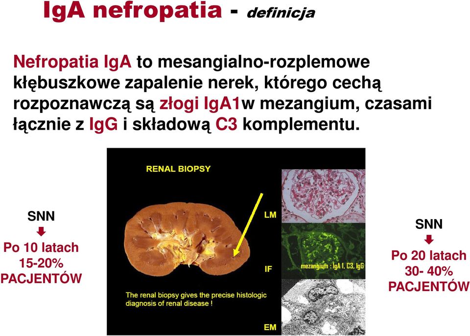 mezangium, czasami łącznie z IgG i składową C3 komplementu.