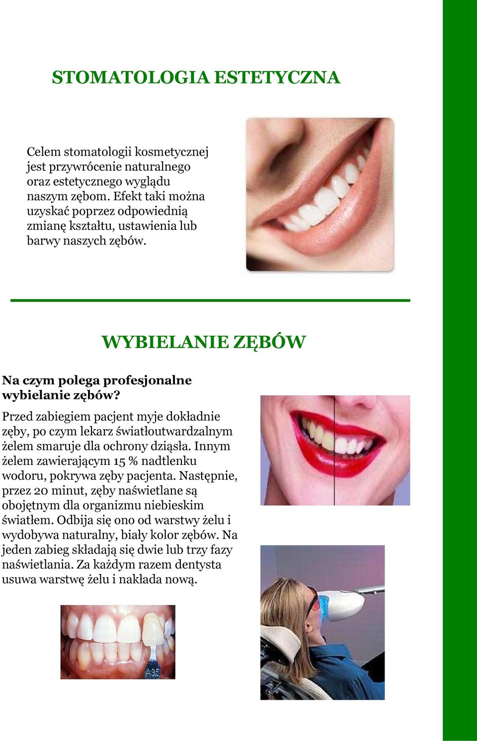 WYBIELANIE ZĘBÓW Przed zabiegiem pacjent myje dokładnie zęby, po czym lekarz światłoutwardzalnym żelem smaruje dla ochrony dziąsła.