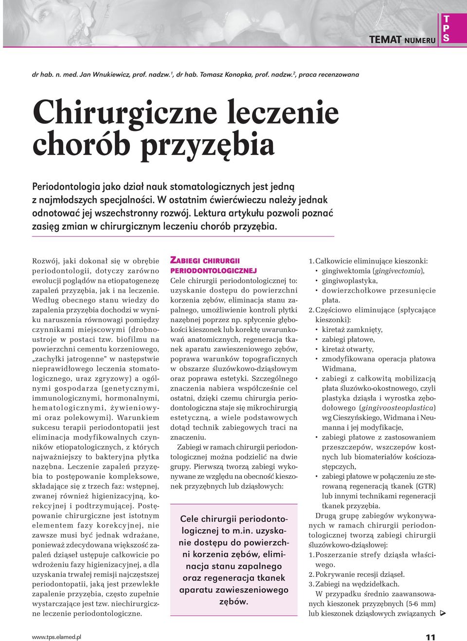 W ostatnim ćwierćwieczu należy jednak odnotować jej wszechstronny rozwój. Lektura artykułu pozwoli poznać zasięg zmian w chirurgicznym leczeniu chorób przyzębia.