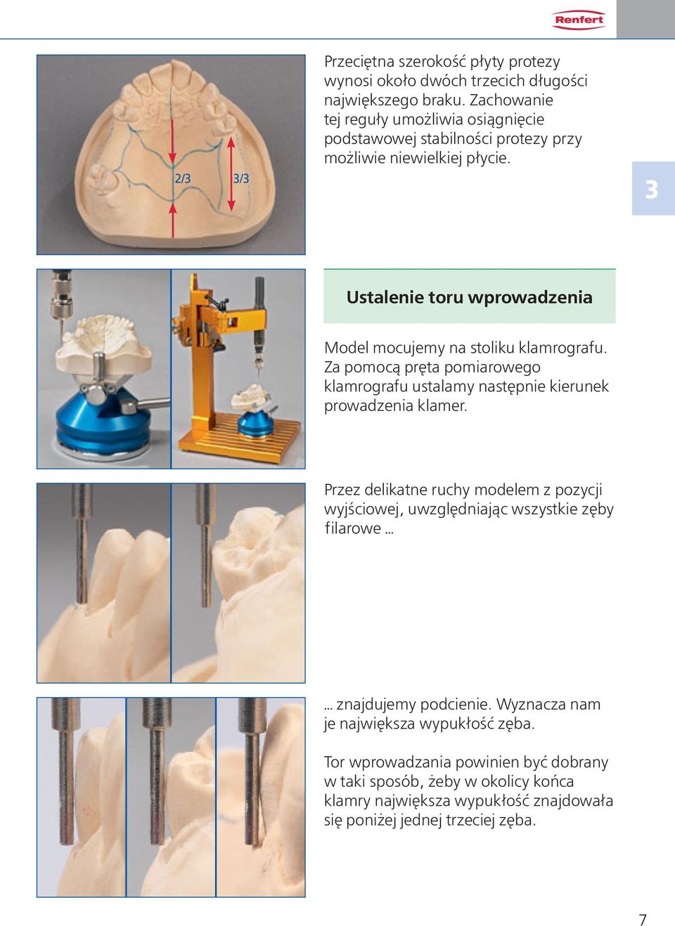 3 Ustalenie toru wprowadzenia Model mocujemy na stoliku klamrografu. Za pomocą pręta pomiarowego klamrografu ustalamy następnie kierunek prowadzenia klamer.