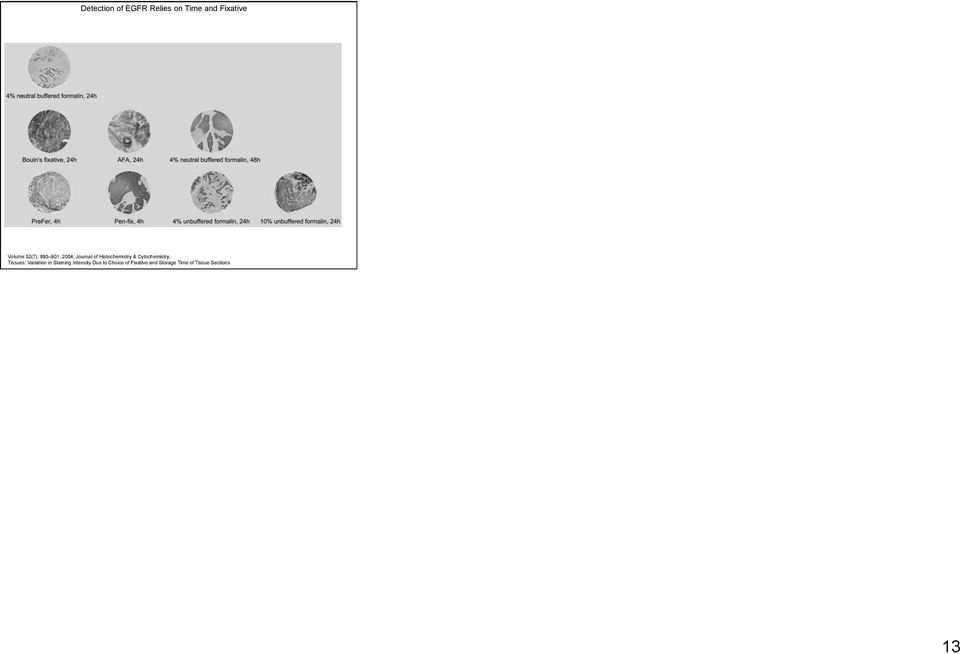 Detection of EGFR in Paraffin-embedded Tumor Tissues: Variation in