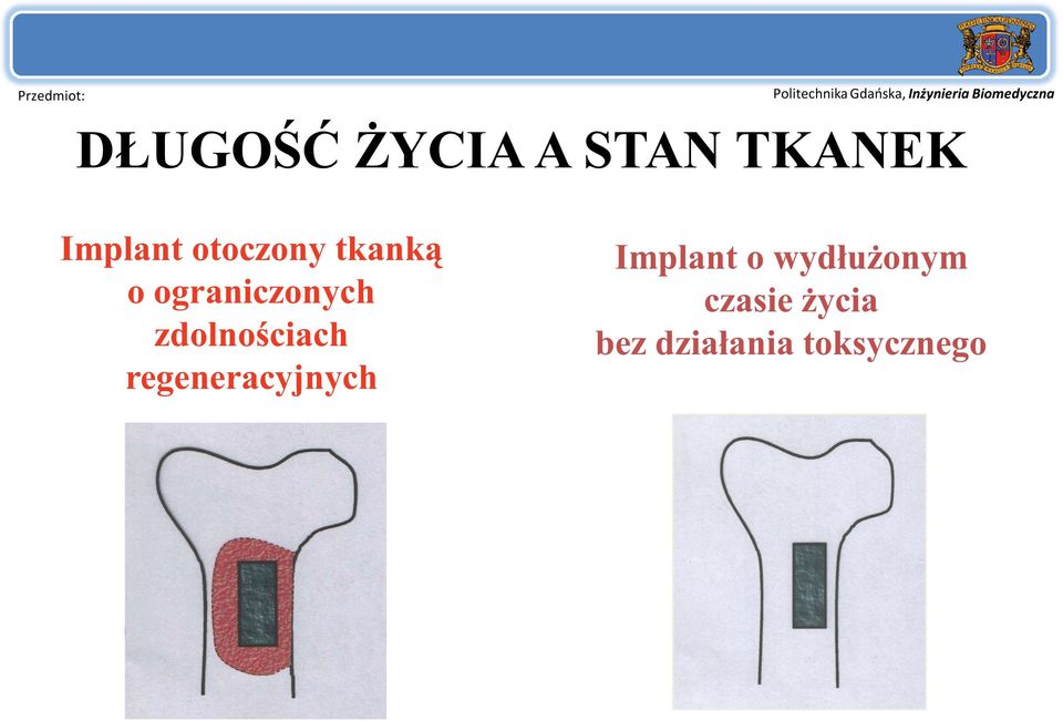 zdolnościach regeneracyjnych Implant o