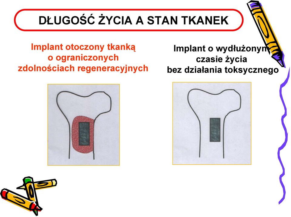 zdolnościach regeneracyjnych Implant o