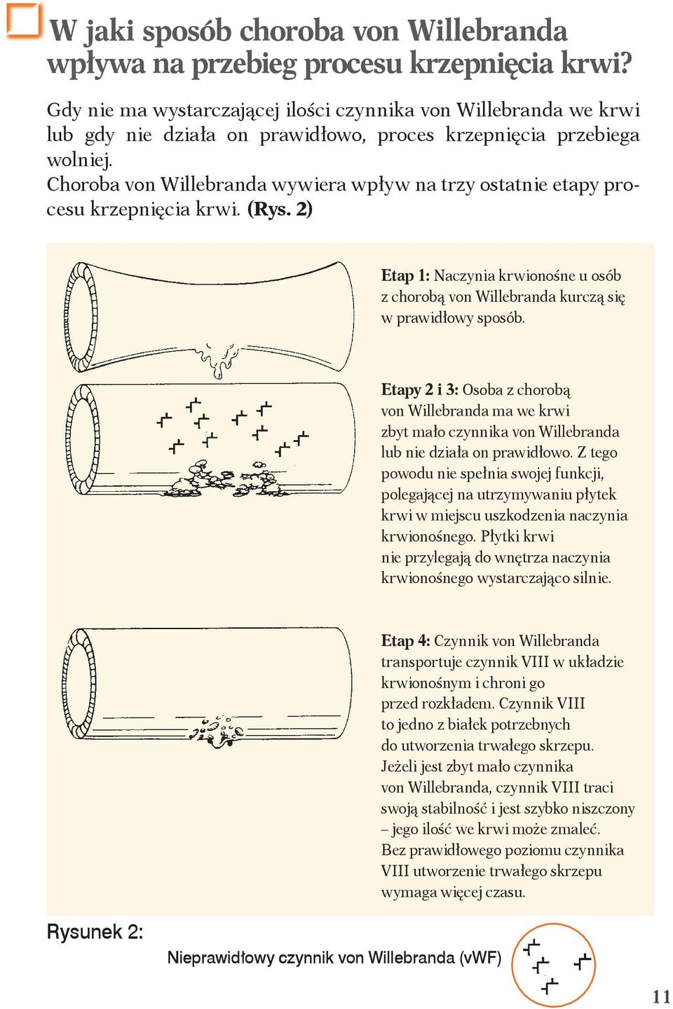 Choroba von Willebranda wywiera wpływ na trzy ostatnie etapy procesu krzepnięcia krwi. (Rys. 2) Etap 1: Naczynia krwionośne u osób z chorobą von Willebranda kurczą się w prawidłowy sposób.