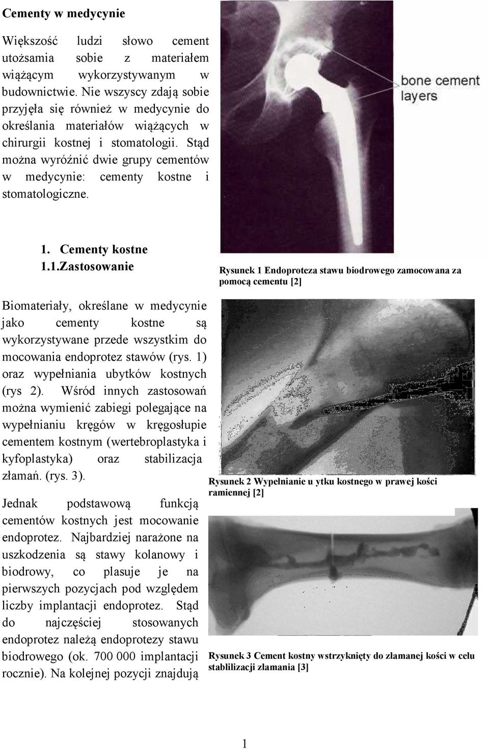 Stąd można wyróźnić dwie grupy cementów w medycynie: cementy kostne i stomatologiczne. 1.