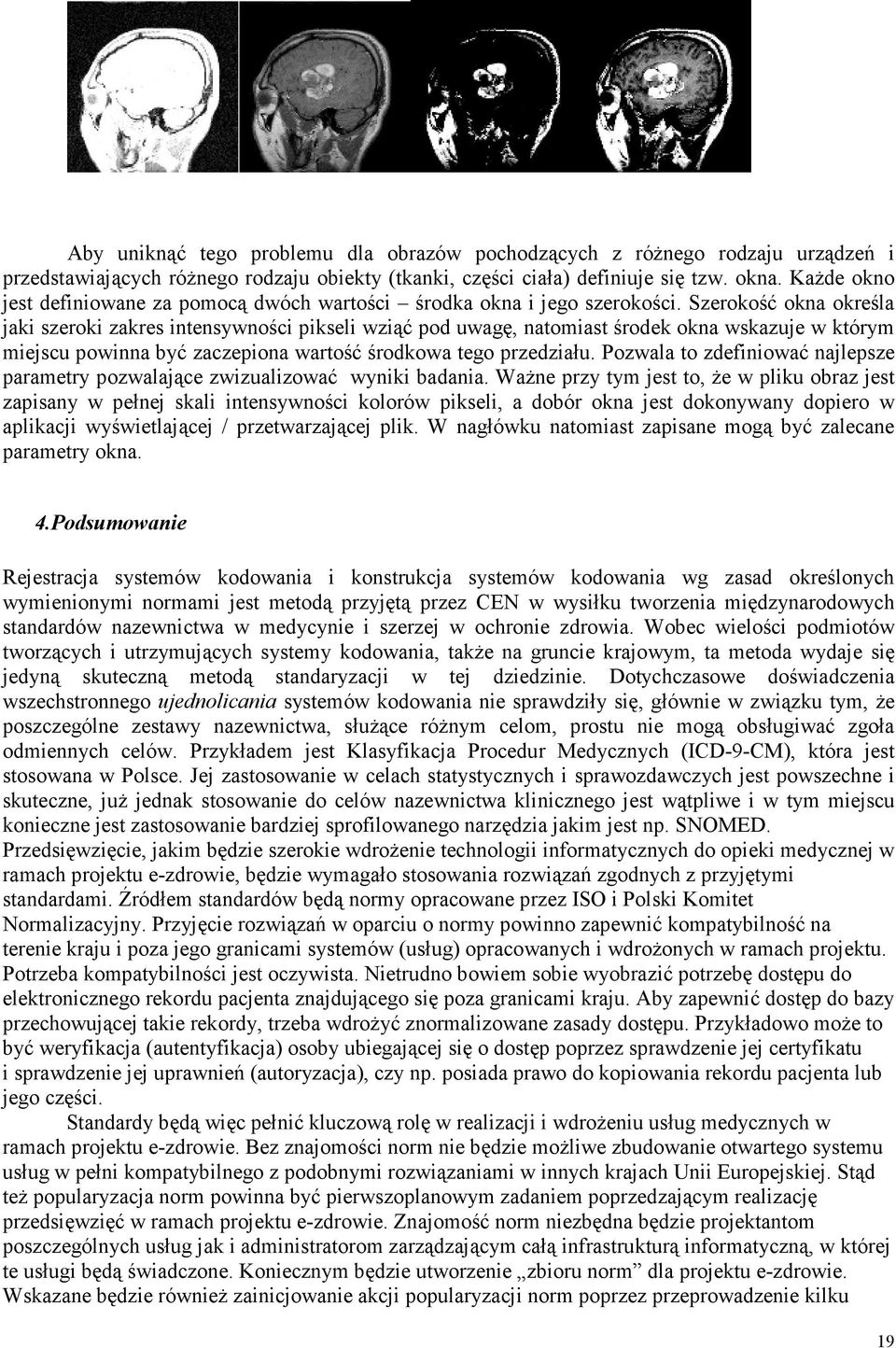 Szerokość okna określa jaki szeroki zakres intensywności pikseli wziąć pod uwagę, natomiast środek okna wskazuje w którym miejscu powinna być zaczepiona wartość środkowa tego przedziału.