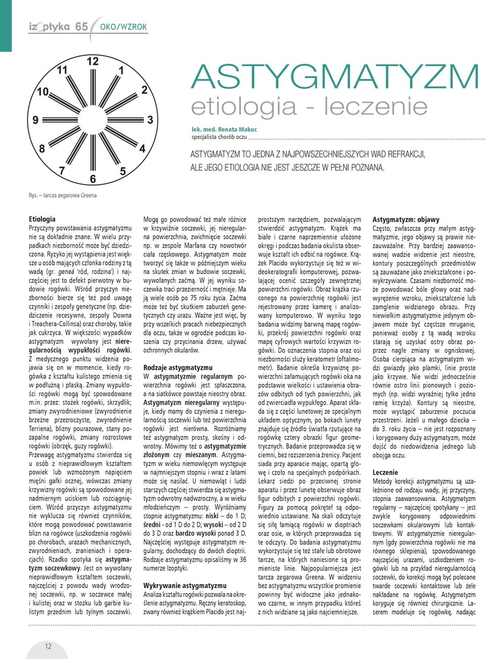 tarcza zegarowa Greena Etiologia Przyczyny powstawania astygmatyzmu nie są dokładnie znane. W wielu przypadkach niezborność może być dziedziczona.