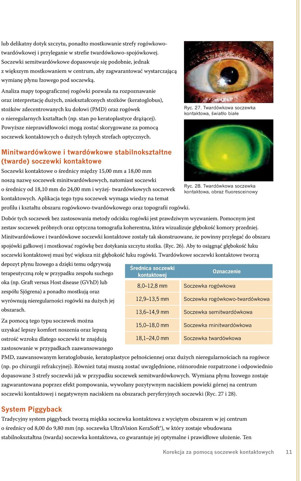 Analiza mapy topograficznej rogówki pozwala na rozpoznawanie oraz interpretację dużych, zniekształconych stożków (keratoglobus), stożków zdecentrowanych ku dołowi (PMD) oraz rogówek o nieregularnych