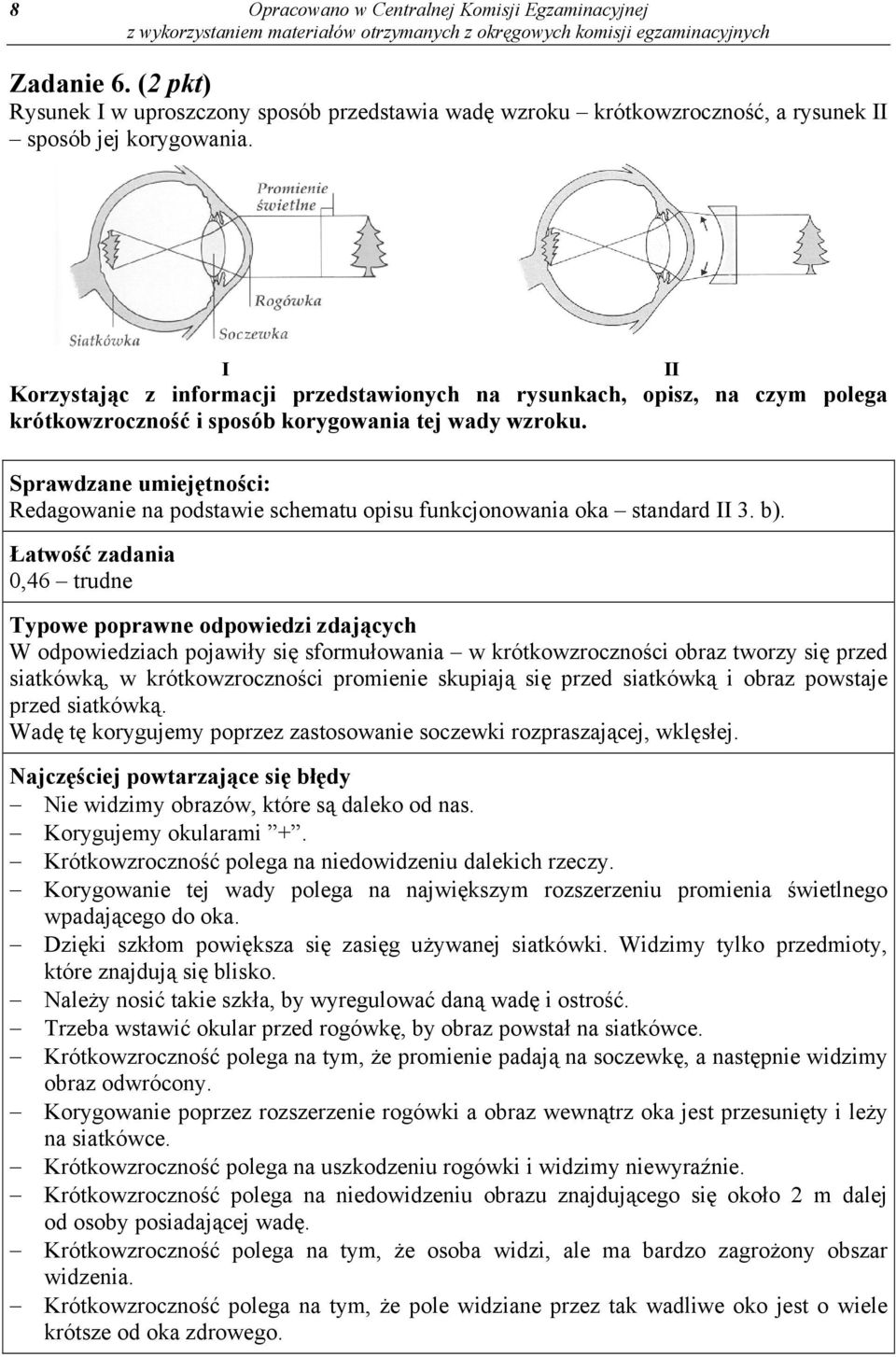 : Redagowanie na podstawie schematu opisu funkcjonowania oka standard II 3. b).